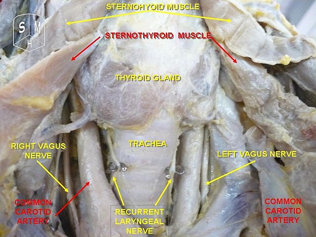 Photograph of the thyroid gland.