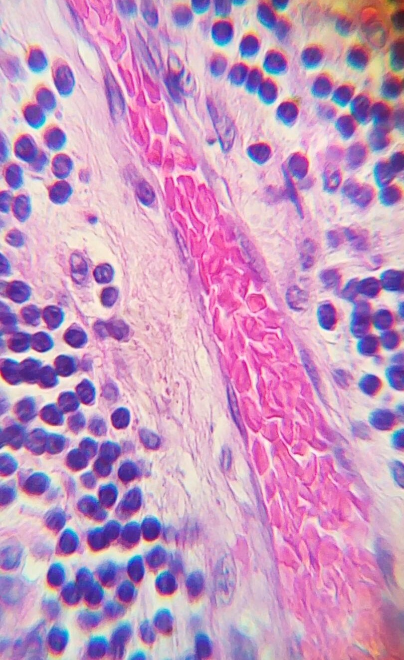 Photomicrograph of a blood vessel.