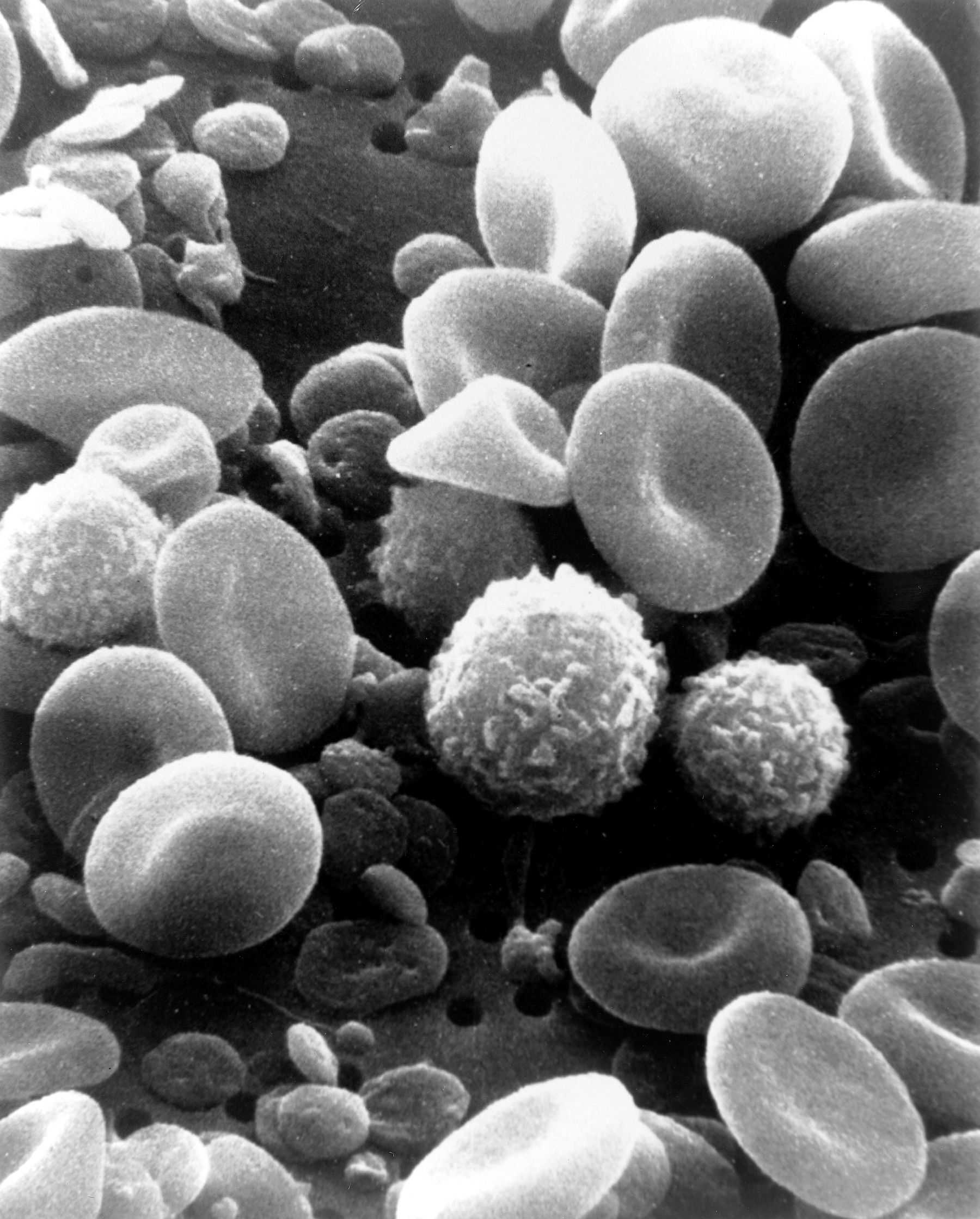 Scanning electron micrograph of white blood cells.