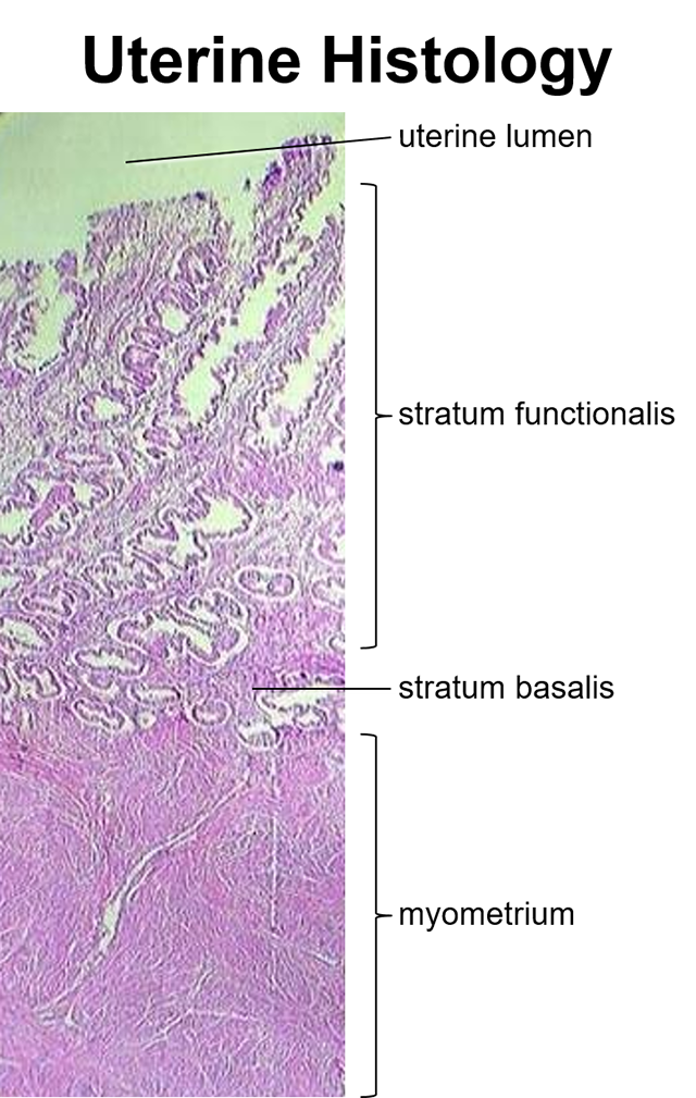 Labeled photomicrograph of the layers of the uterus.