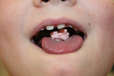 Chewing gum with mouth open.