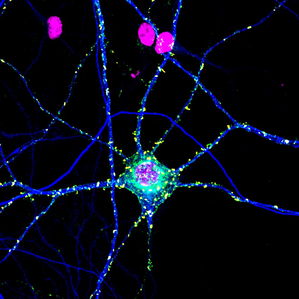 Photograph of the synapses which give information to a neuron