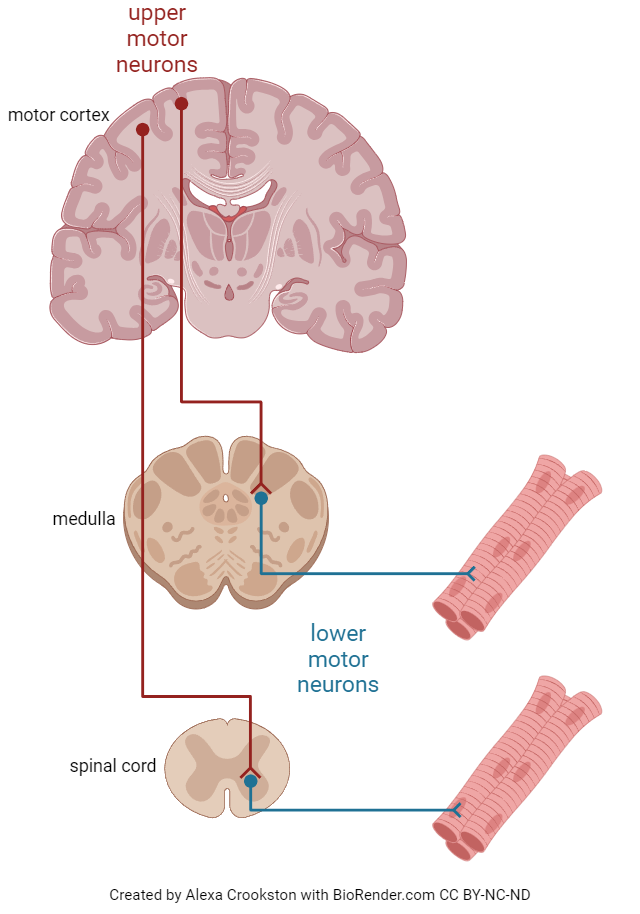 Diagram showing examples of upper and lower motor neurons.