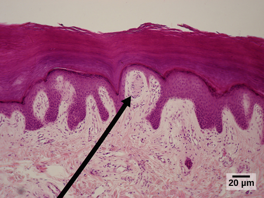 Photomicrograph of a Meissner corpuscle.