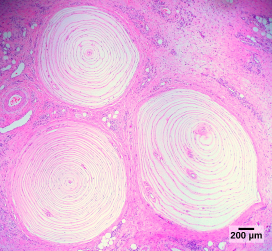 Photomicrograph of Pacinian corpuscles