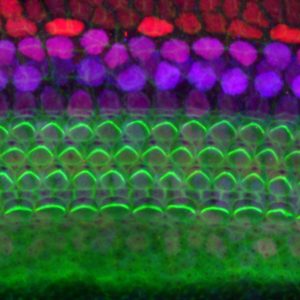 Photomicrograph of the hair cells of the inner ear.