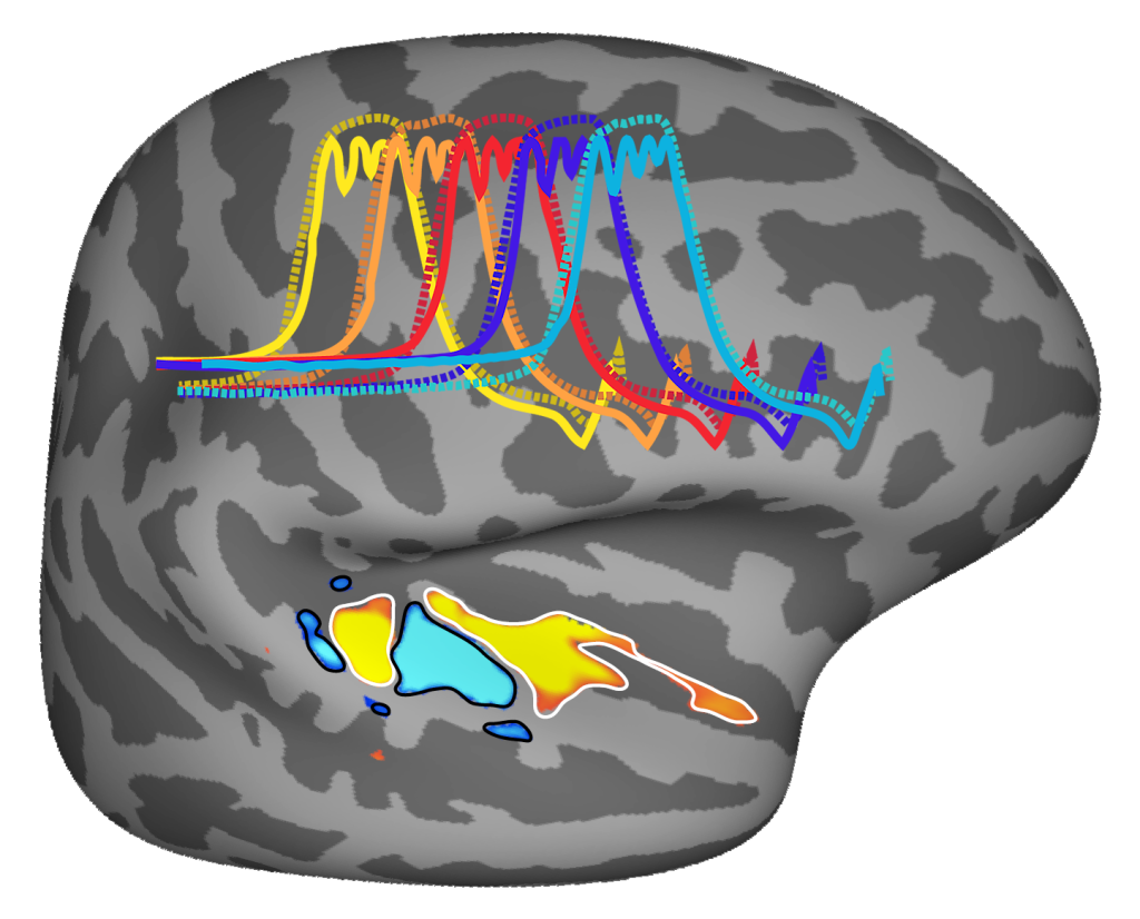 A diagram illustrating how tones are mapped in the auditory cortex.