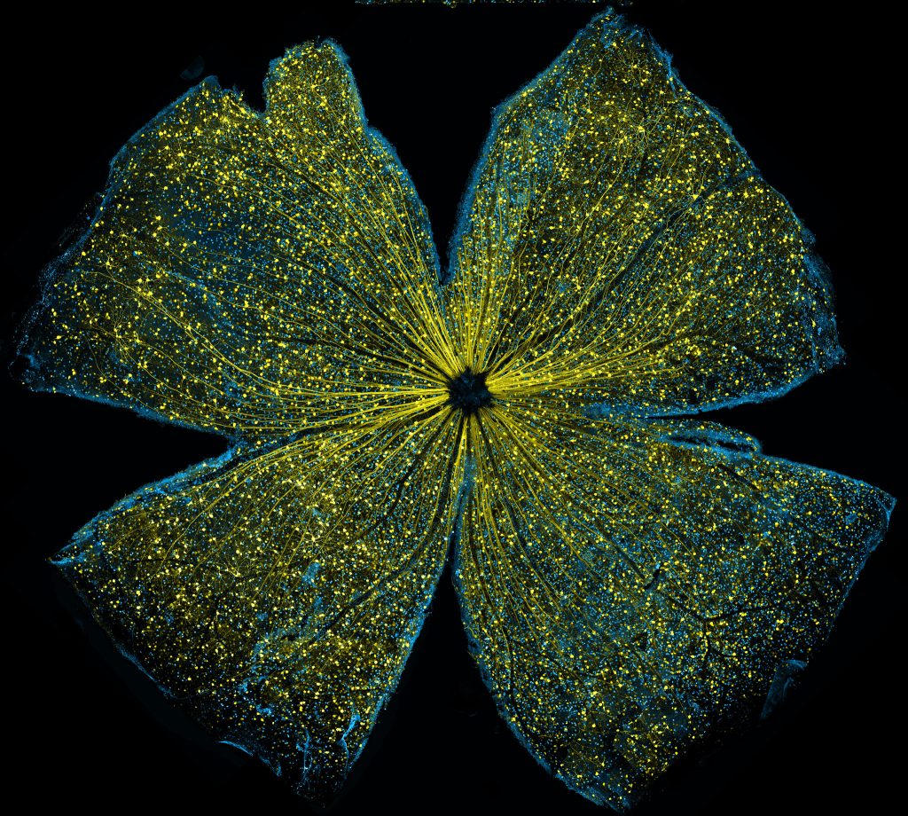 A photomicrograph of the mouse retina.