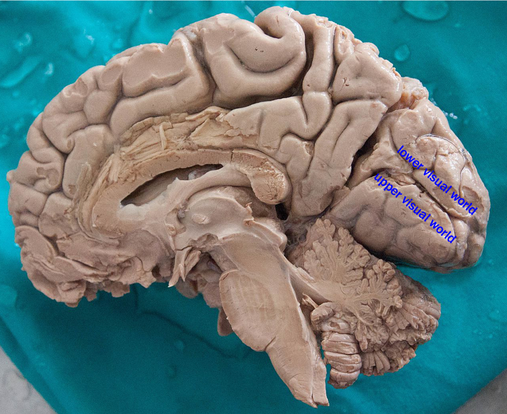 Photograph of a midsagittal cut of the human brain.