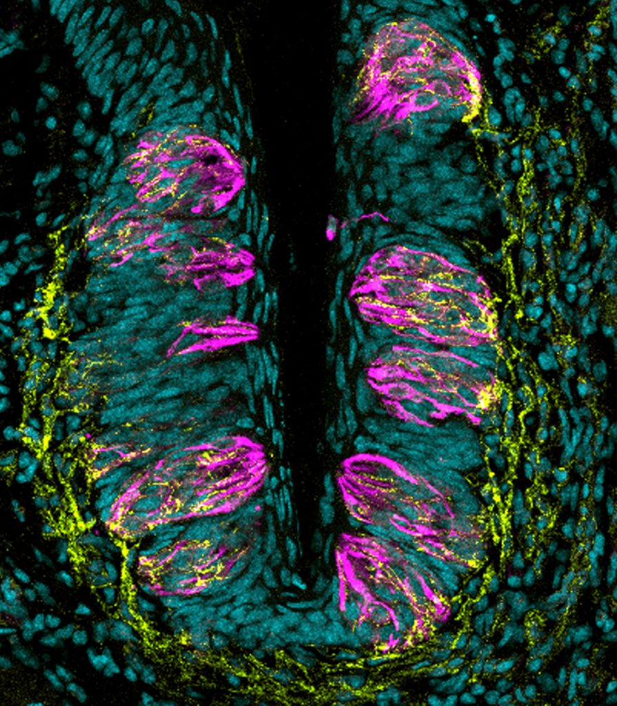 Photomicrograph of taste buds on the tongue.