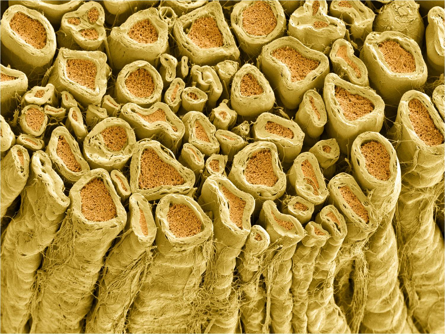 Scanning electron photomicrograph of myelinated axons in a rat nerve.