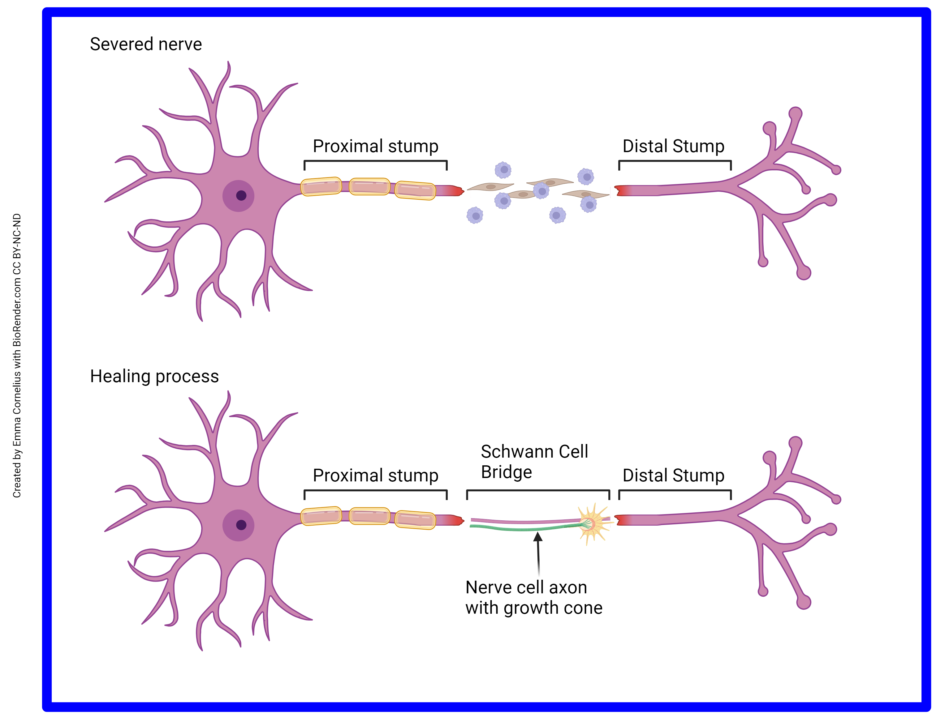 Diagram showing the process of repairing a cut or crushed nerve axon.