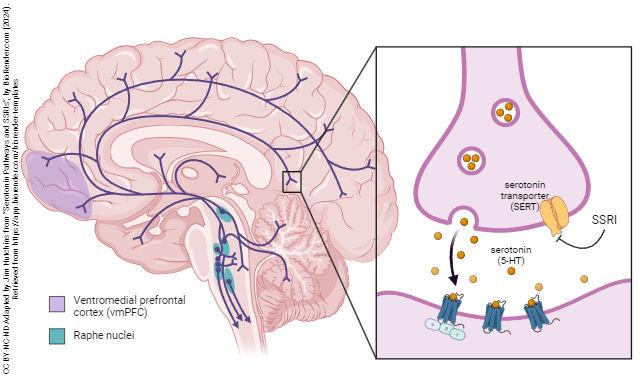 Diagram showing the sources of serotonin and the effects of SSRIs on serotonergic synapses.