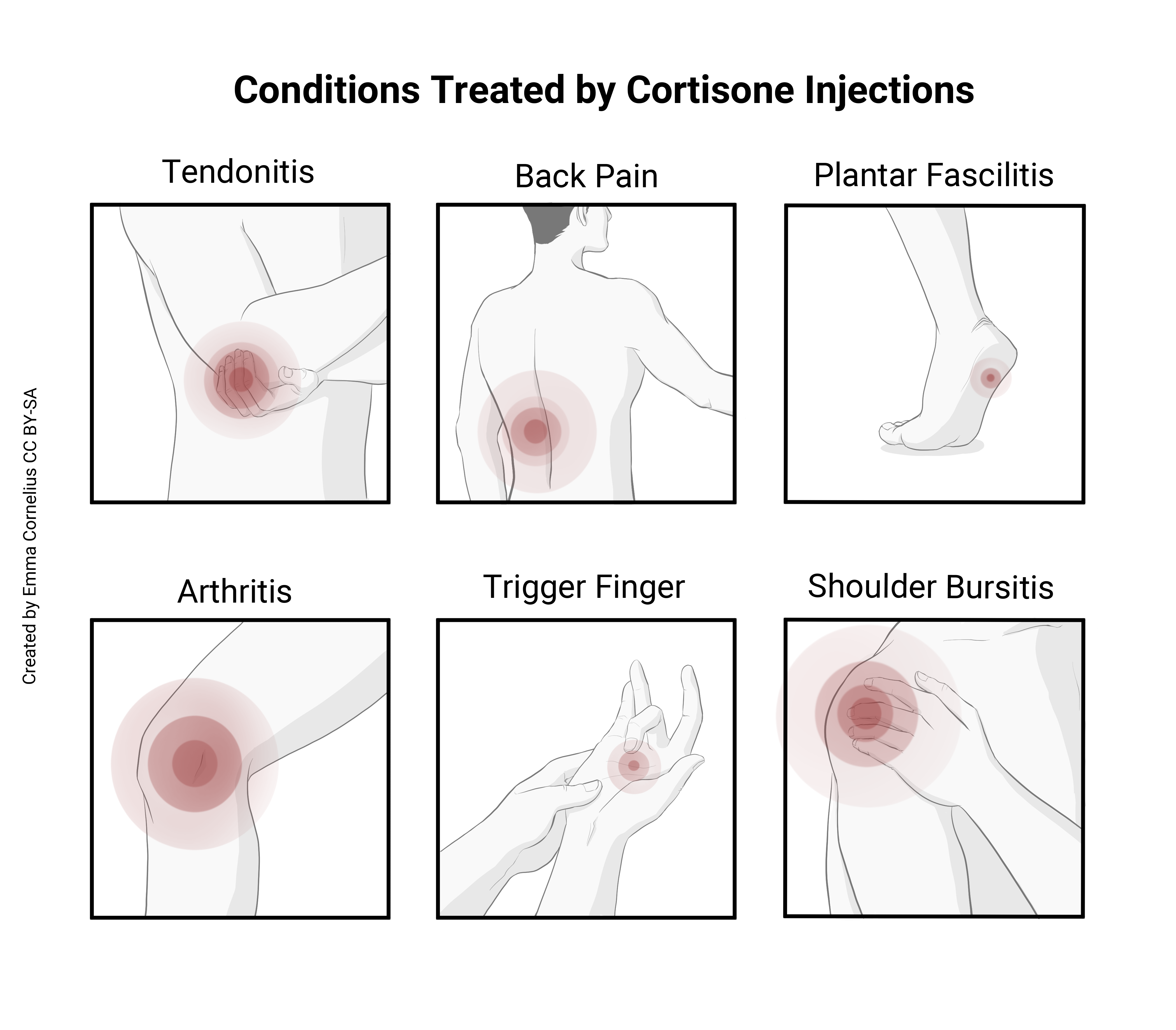 Diagrams illustrating the various uses of glucocorticoids.