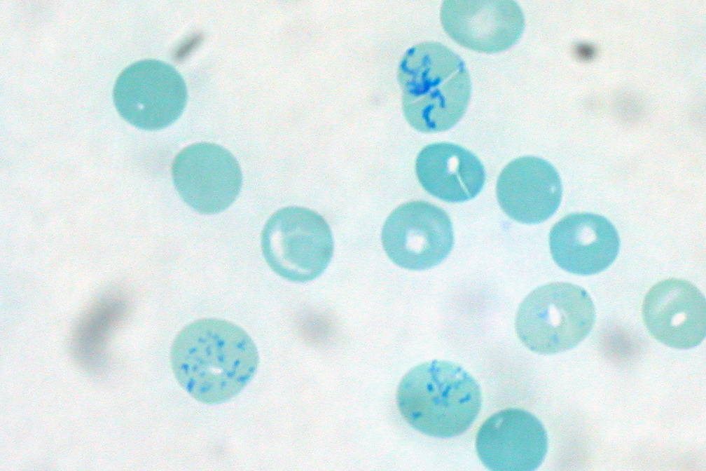 Photomicrograph of reticulocytes.