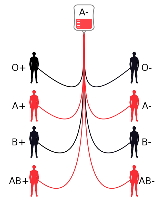 Transfusion compatibility diagram assuming a donation of A negative blood.