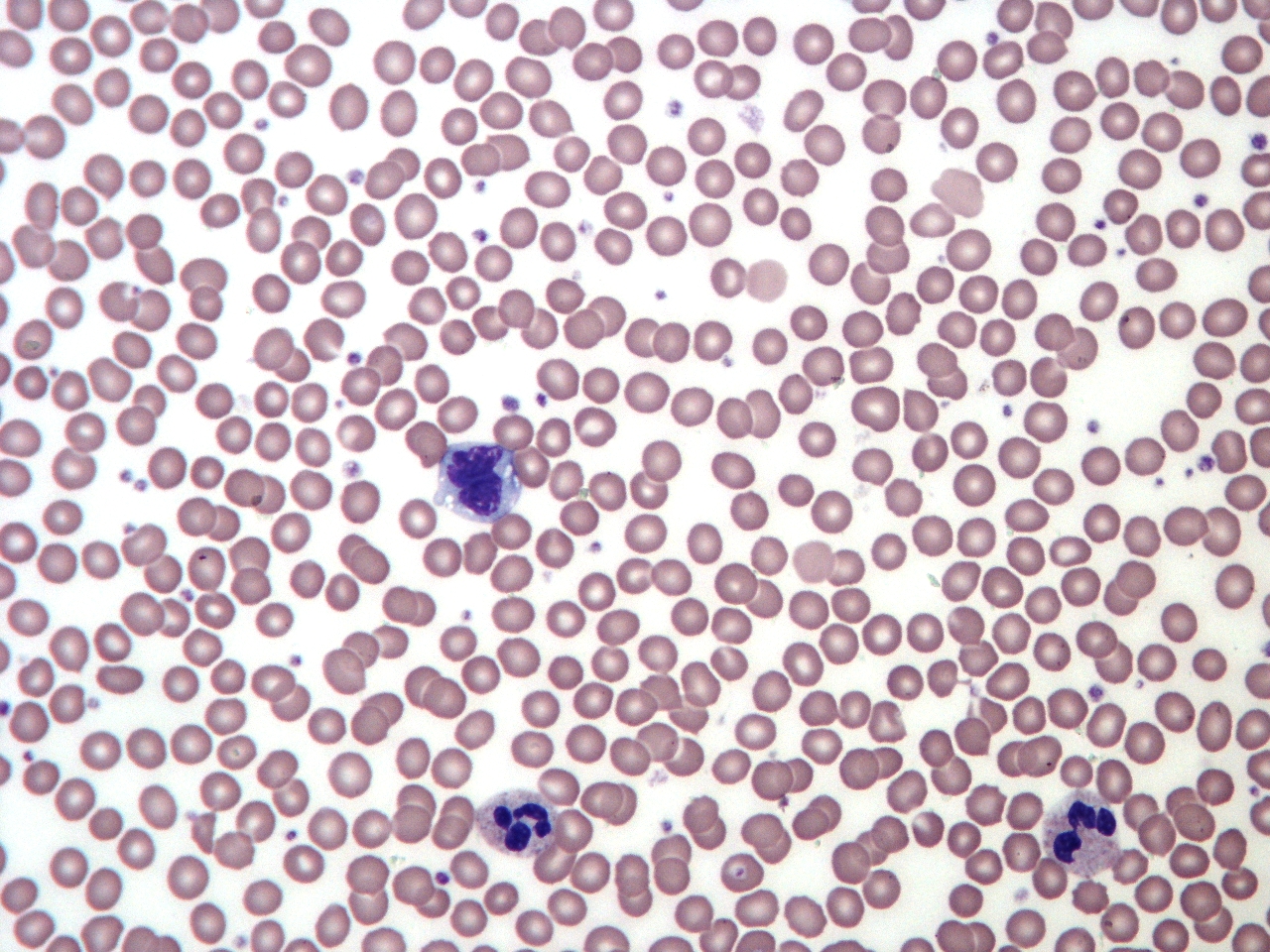 Photomicrograph of a normal blood smear.