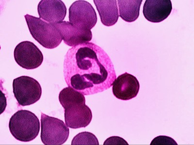 Photomicrograph of a neutrophil.