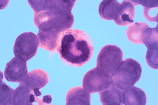 Photomicrograph of a band neutrophil.