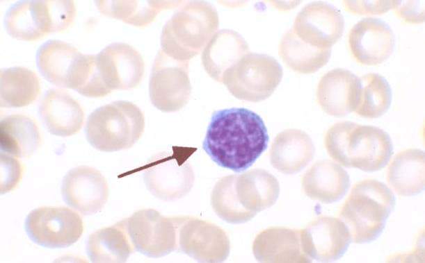 Photomicrograph of a lymphocyte.