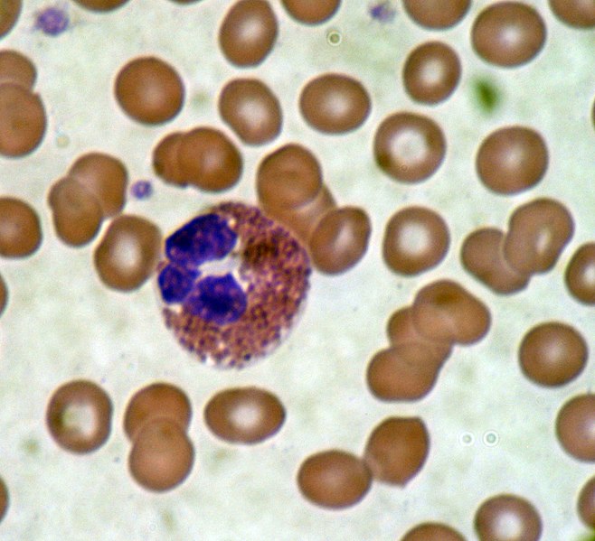 Photomicrograph of an eosinophil.