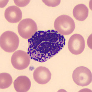 Photomicrograph of a basophil.