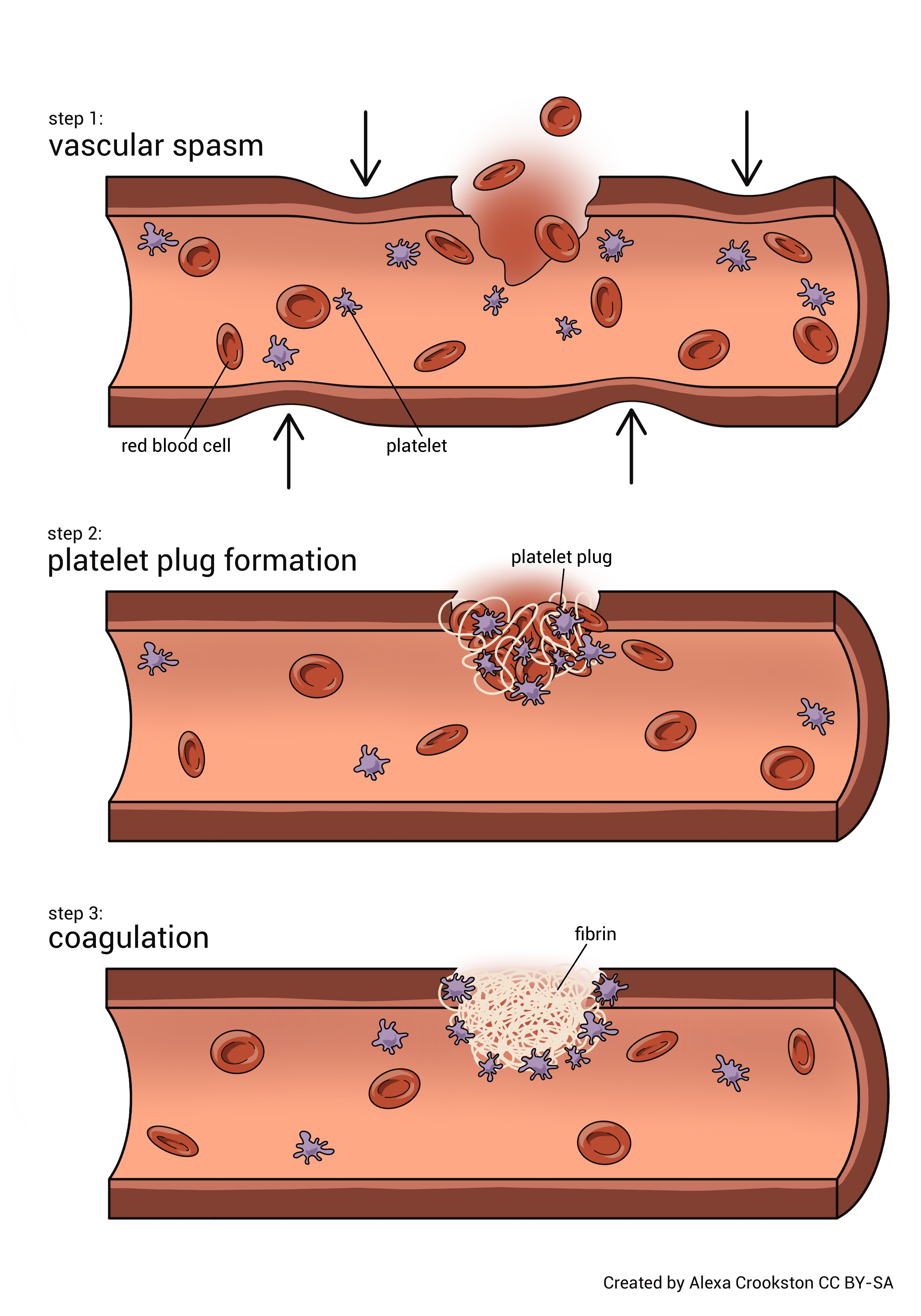 Diagram showing the process of hemostasis.