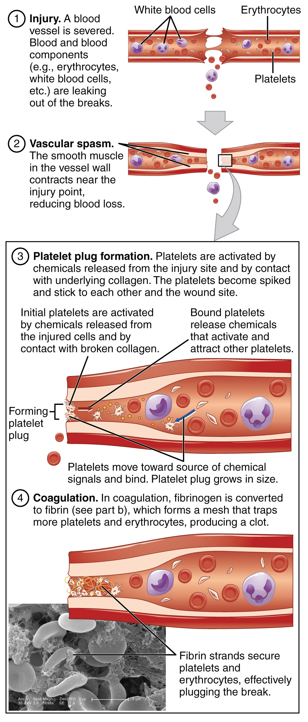 Diagram showing the steps in the formation of a blood clot.