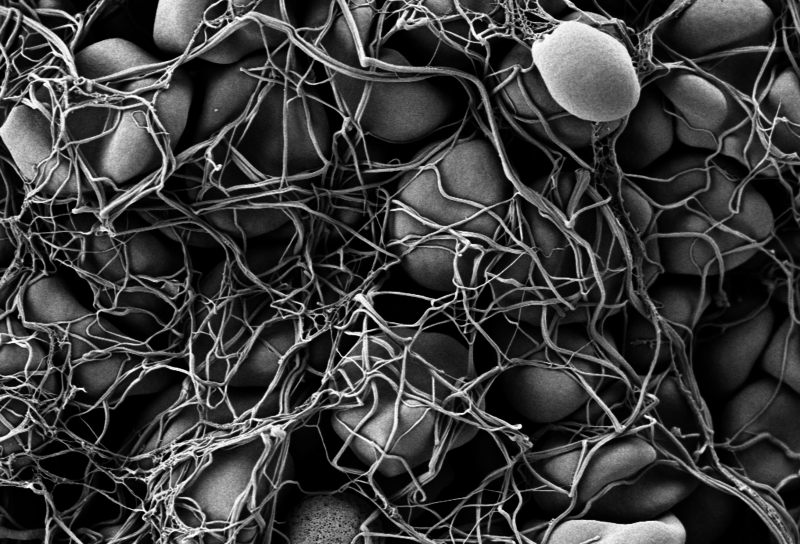 Scanning electron micrograph of a blood clot.