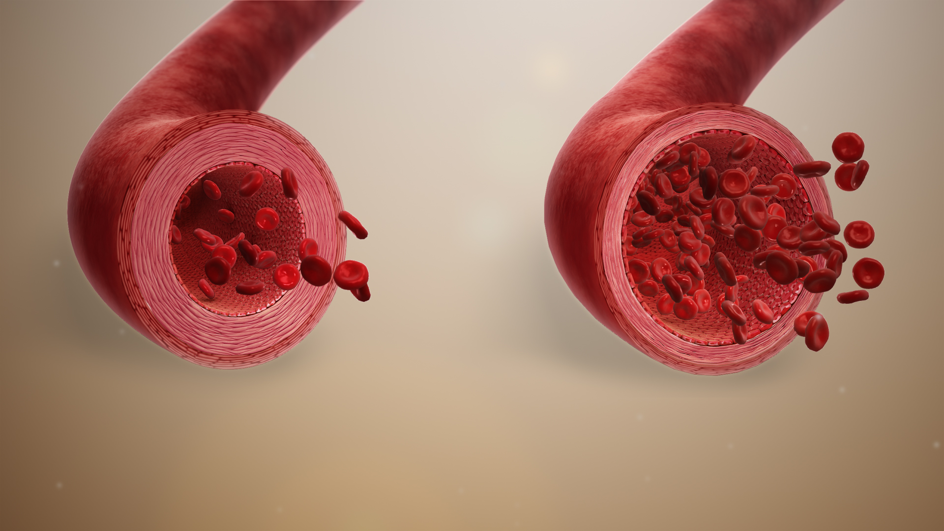 Illustration of the process of vasodilation.