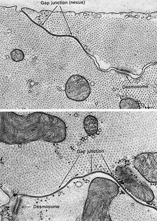 Electron micrograph of desmosomes and gap junctions in cardiac muscle cells.