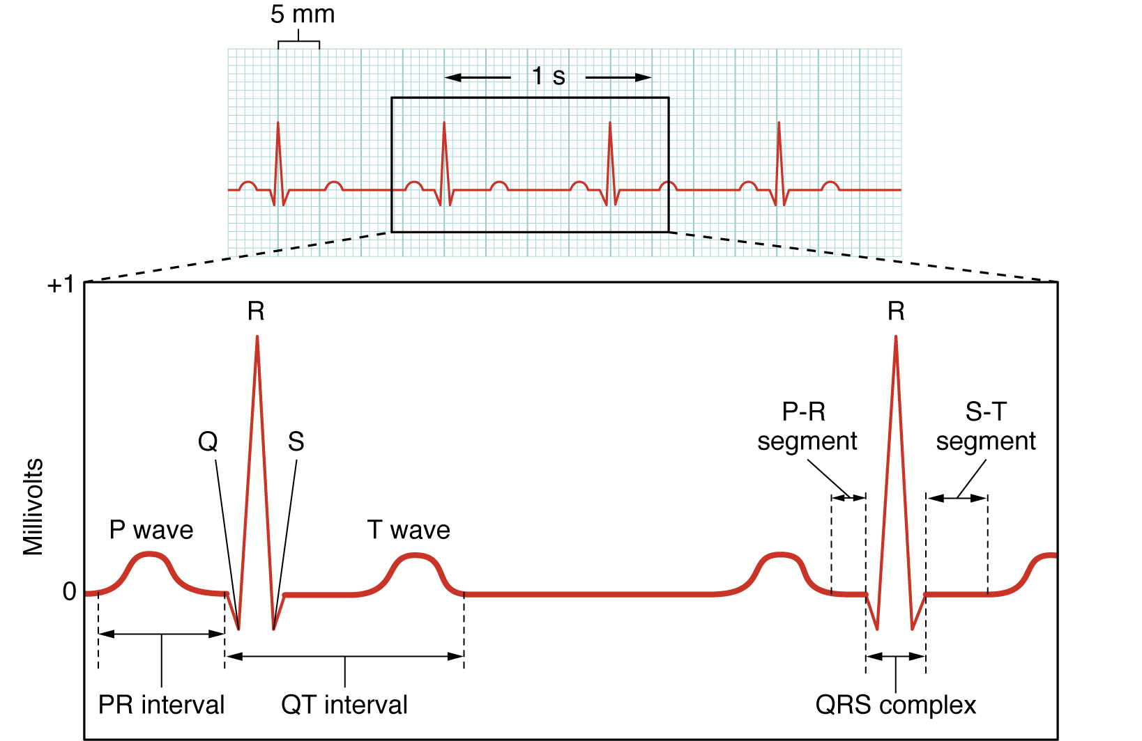 An electrocardiogram trace.