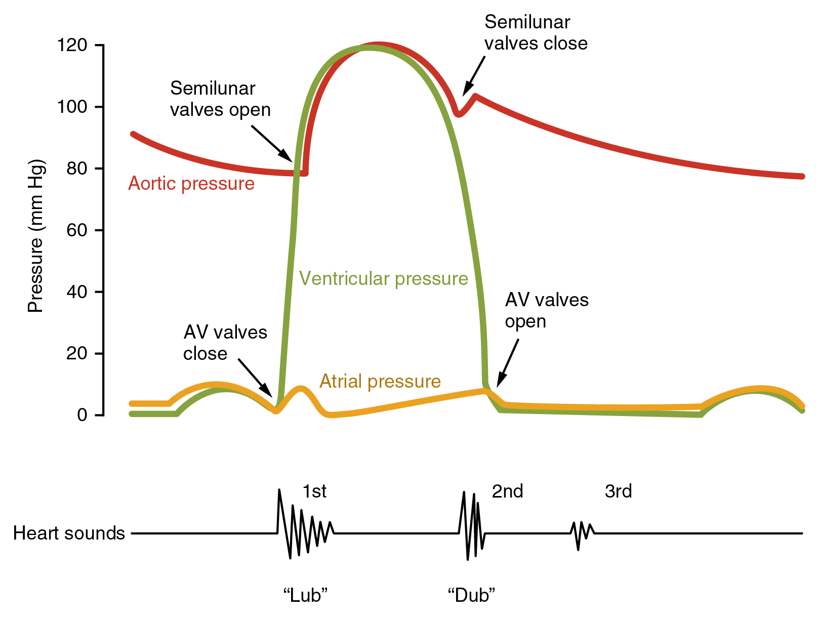 Diagram showing the source of heart sounds.