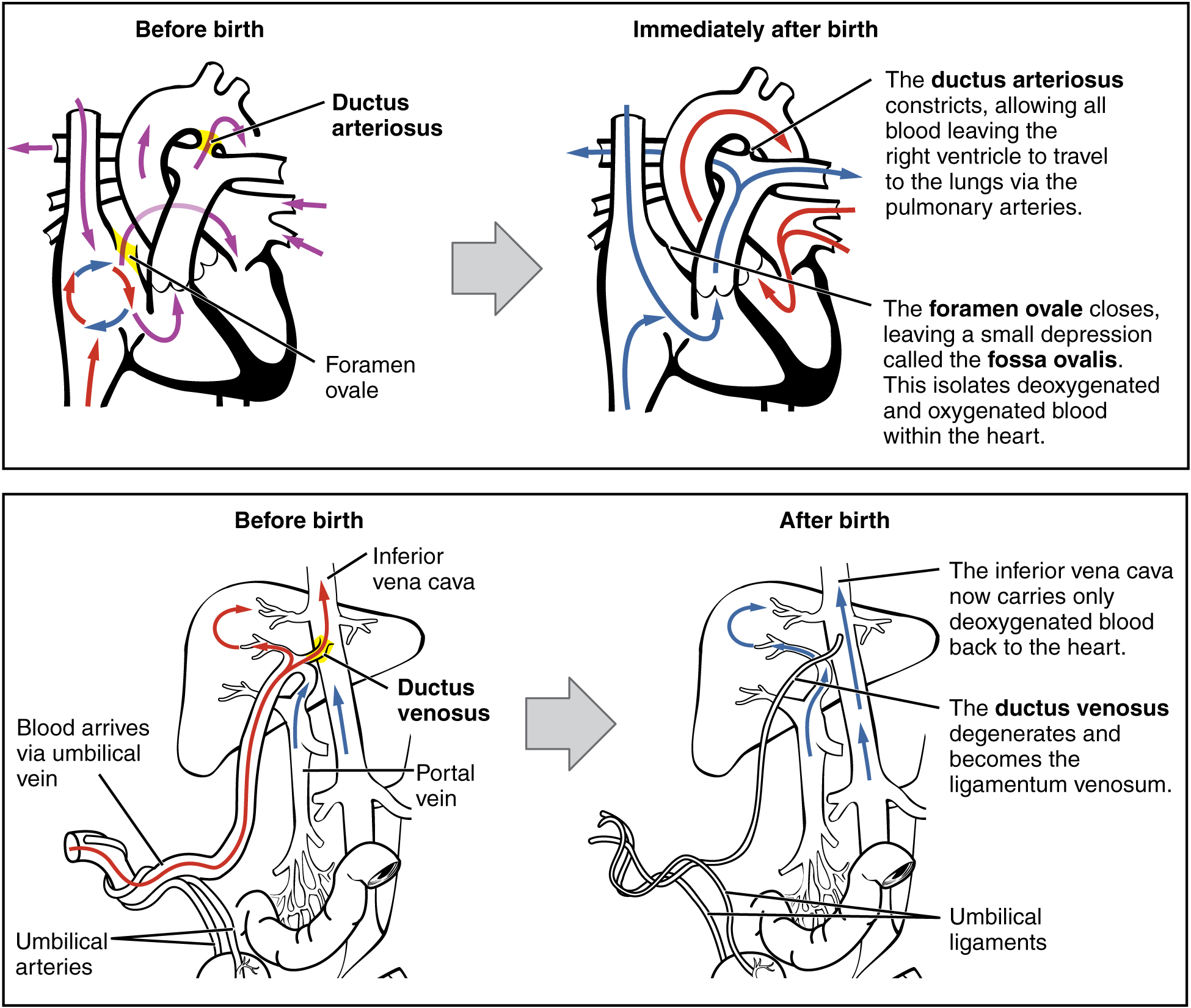 Diagram showing the changes that transform fetal circulatory pathways into adult circulatory pathways.