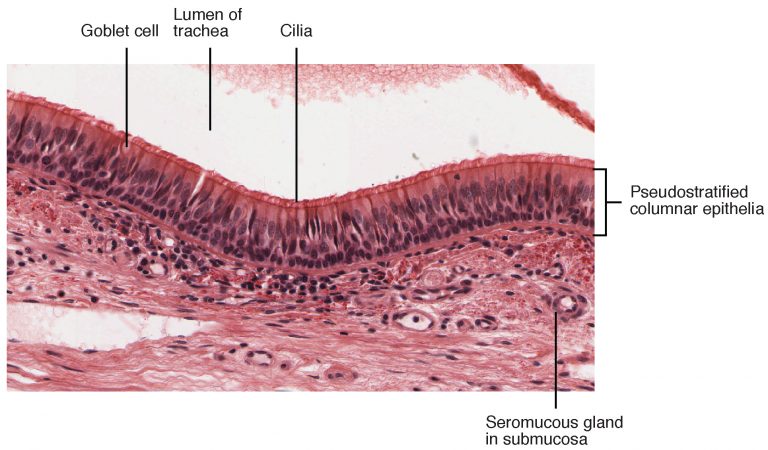 Photomicrograph of the respiratory epithelium.