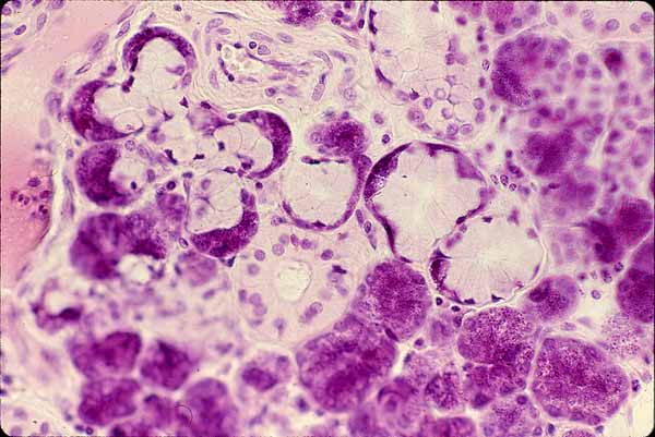 Photomicrograph of a mixed salivary galnd showing mucous acini.