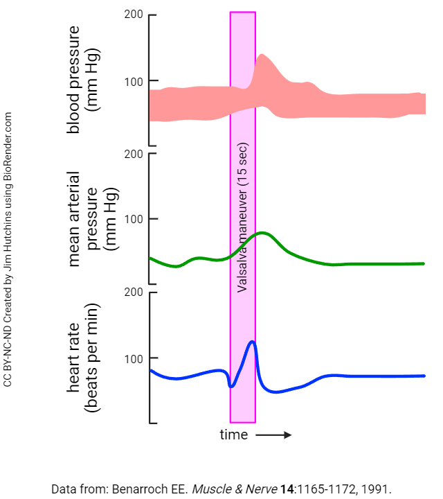 Graph of the blood pressure, mean arterial pressure, and heart rate before, during, and after a Valsalva maneuver.