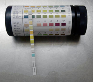 Photograph of Multistix urine test strips.