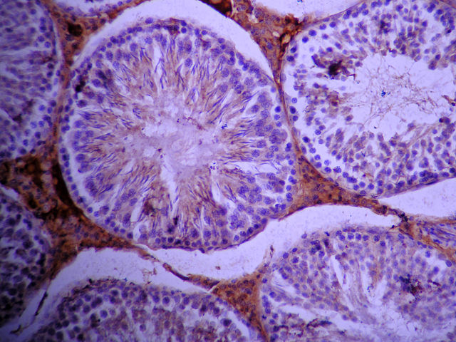 Photomicrograph of rat seminiferous tubules.