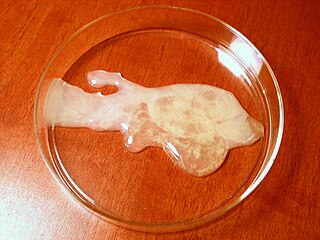 Photograph of human semen in a Petri dish.